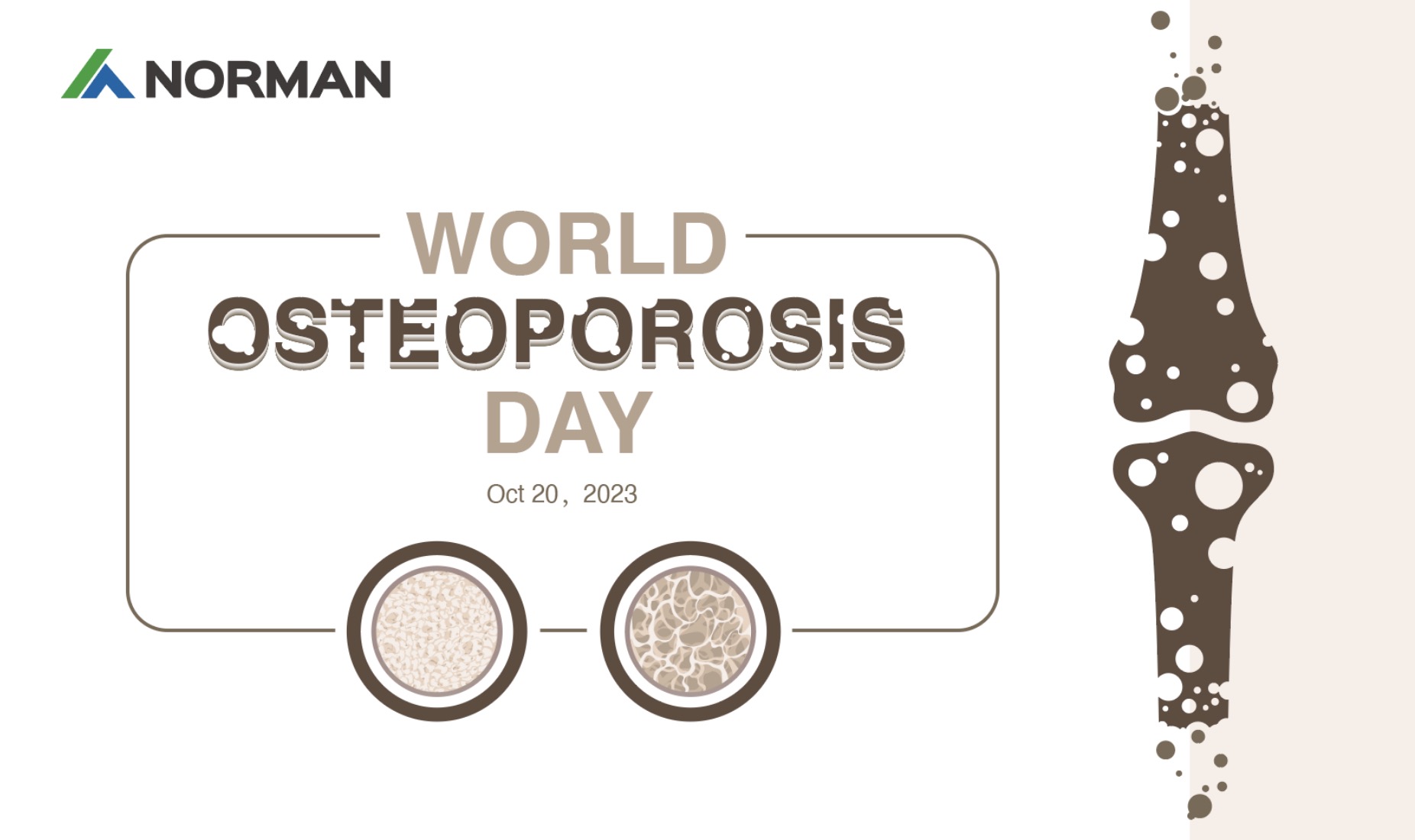 Всемирный день остеопороза